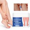 Varicose Veins Cream-Improve Blood Circulation-Relief Swelling And Pain-Minimize Varicose Vein & Spider Vein, 50g