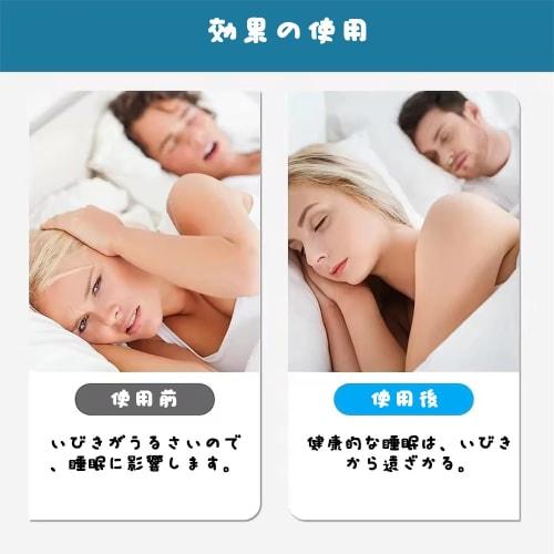 YUHENGCT Anti-Snoring Nose Clips, Nasal Cavity Expander, Promotes Nasal Breathing, Prevents Mouth Breathing, Sleep Aid, Washable, Transparent, Include
