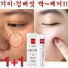 Freckle Cream, Age Spot, Freckle Removal, Melanon Cream, Spot Skin Improvement, Face Whitening, Random Gift, 20g, 2 Pieces
