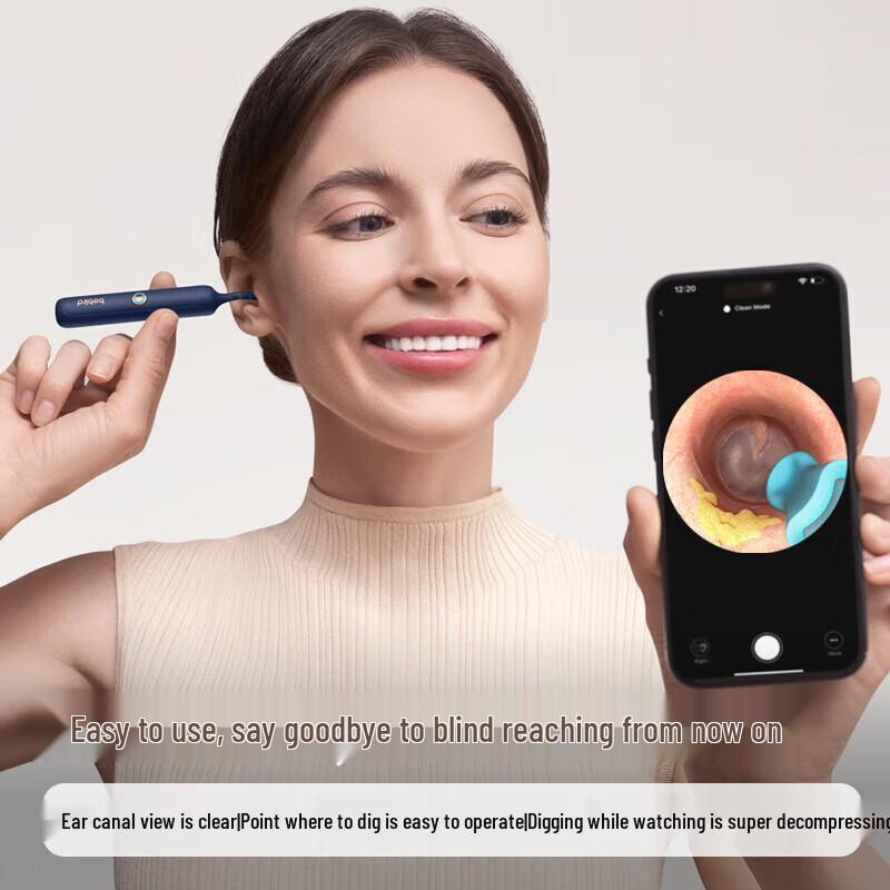 BEBIRD Умный визуальный ушной пинцет с HD-эндоскопом