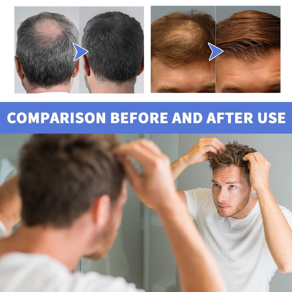 Hair Growth Foam Infused With Biotin Super Powerful Hair Growth To Make Hair Longer And Thicker,60ML