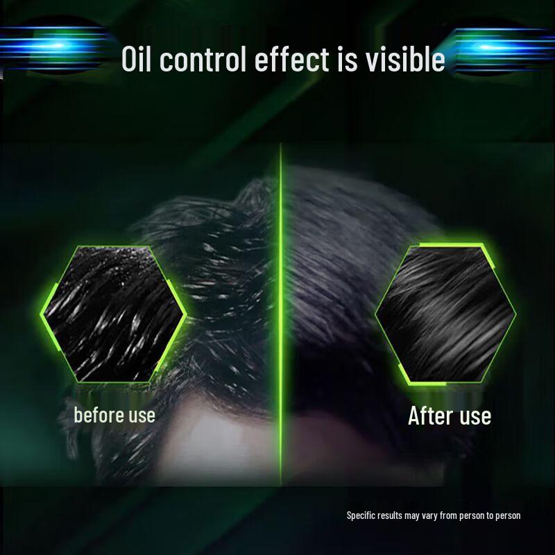 Clear Men Scalp Active Anti-Dandruff Shampoo