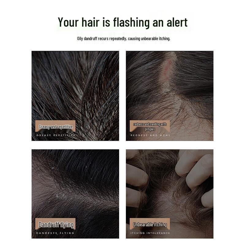 100-Year Runfa Amino Acid Oil Control Volumizing Shampoo