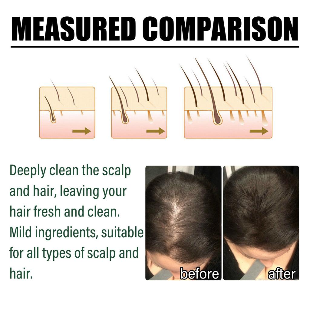 Восстанавливающий шампунь против выпадения волос, несмываемый кондиционер, укрепляющий кондиционер и набор увлажняющих масок для кожи головы, касторовое масло, 100 мл