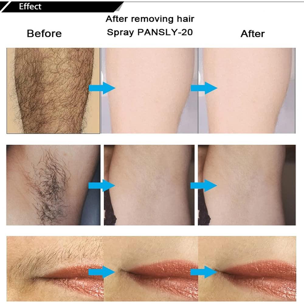 Постоянный ингибитор волос, ингибитор роста волос, ингибитор роста волос для тела, натуральный нераздражающий ингибитор роста волос для мужчин и женщин 50 мл