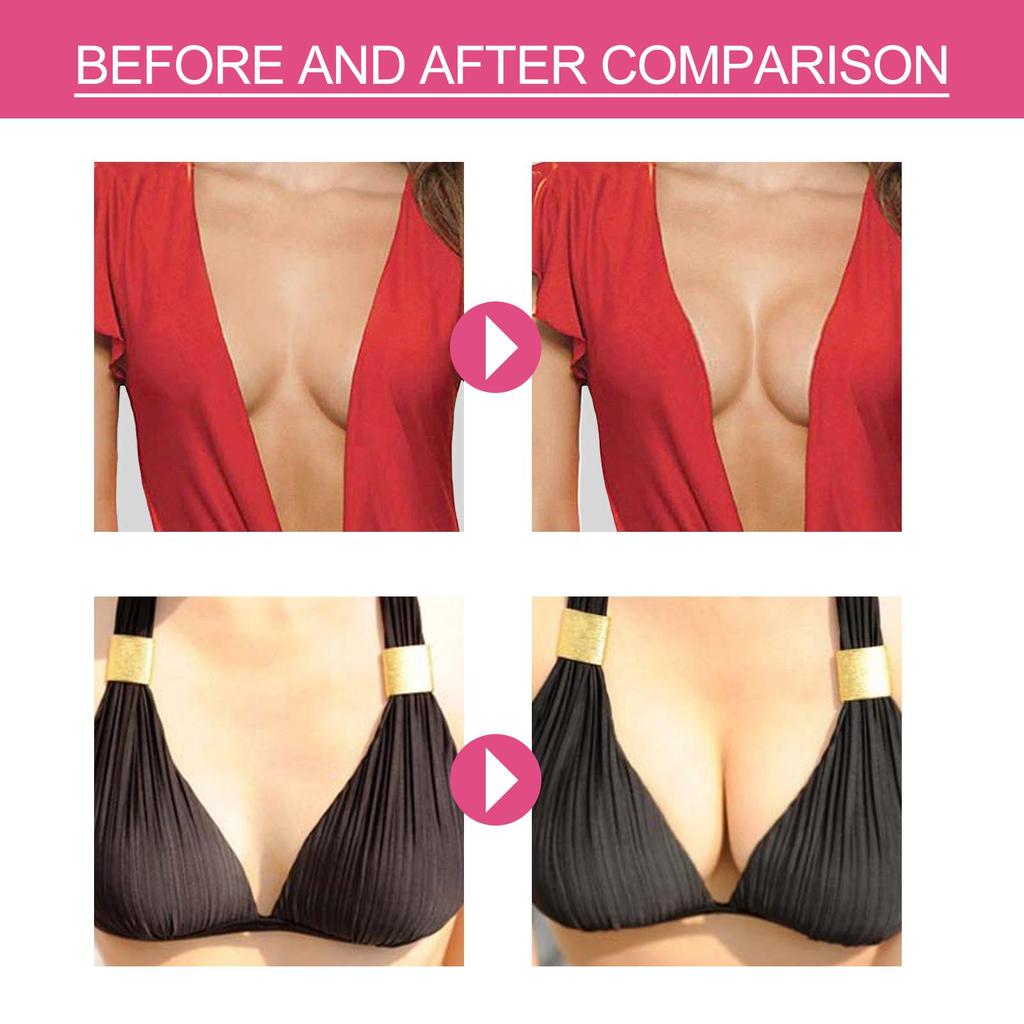 West&Month Невидимая эластичная тканевая лента для подъема груди, не оставляющая шрамов, предотвращающая провисание, расширяющая и собирающая грудь, эластичная тканевая лента