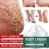 Foot Cream, Heel Cracks To Remove Dead Skin, Skin Care Dry Mask Exfoliation, Gentle and Non-irritating Skin