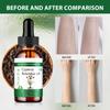 Cyperus Oil - Reduces Body Hair Growth, Smoothes Skin And Hair Removal, Moisturizes And Soothes, Suitable For All Skin Types 60ML