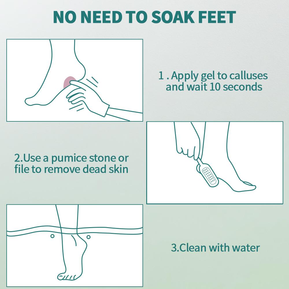 Nailpop Профессиональное средство для удаления мозолей для ног, гель повышенной прочности и набор пилочек для ног, средство для удаления омертвевшей кожи, потрескавшиеся пятки, сухая кожа