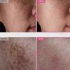 TOSOWOONG Крем с арбутином 7% и транексамовой кислотой 4% 50 мл Осветляющий K-Beauty 2025