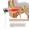 650nm Red Light Ear Care Device - Portable LLLT Technology for Ear Canal Wellness Support
