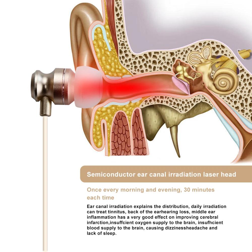 650nm Red Light Ear Care Device - Portable LLLT Technology for Ear Canal Wellness Support