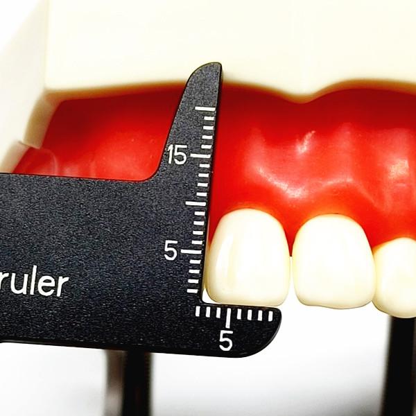 Стоматологическая прецизионная измерительная линейка, измерительная шкала, эндодонтические инструменты, стоматология для фотографии и стоматологии