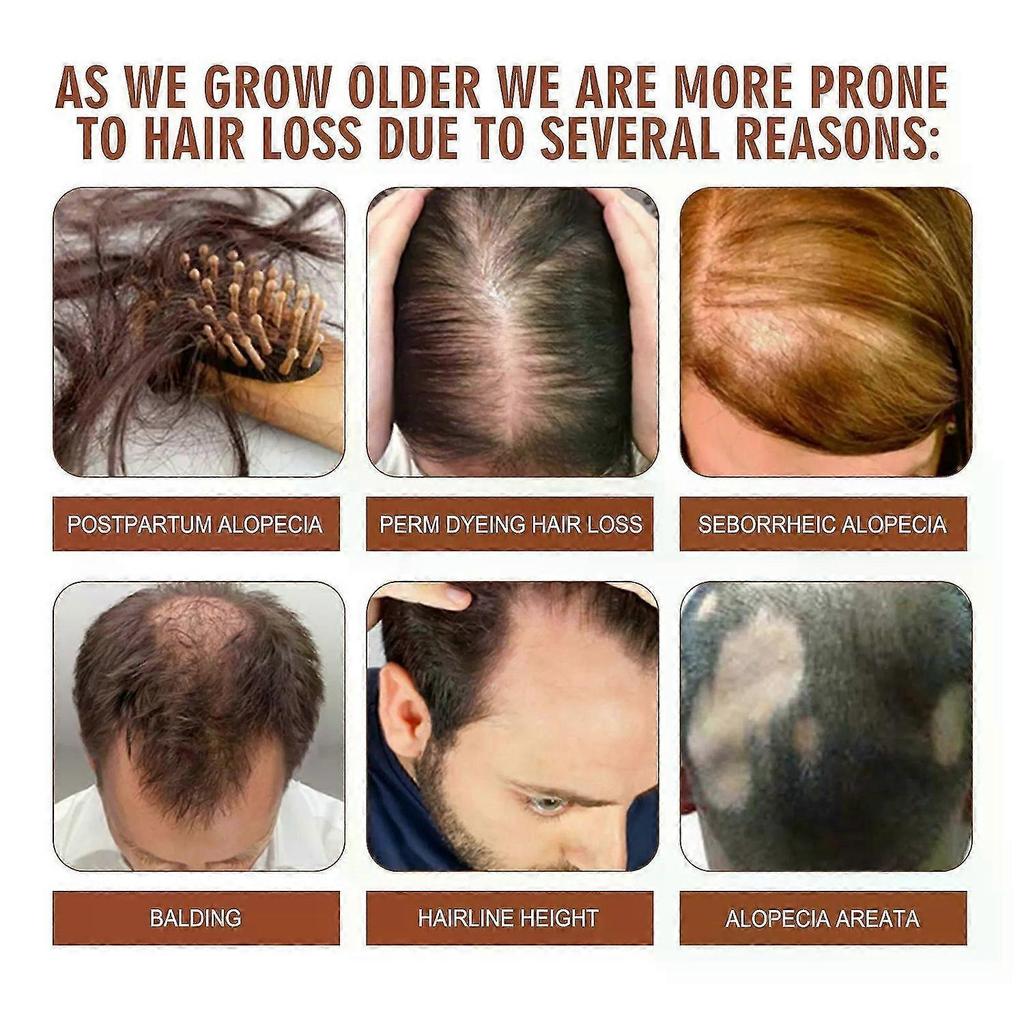 Natural 100% Pure Batana Oil For Hair Growth Batana Oil Butter Hair Mask From Honduras Hair Loss Treatment For Black Men Womenjs