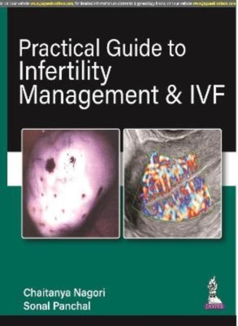 The Practical Guide To Infertility Management & IVF Book