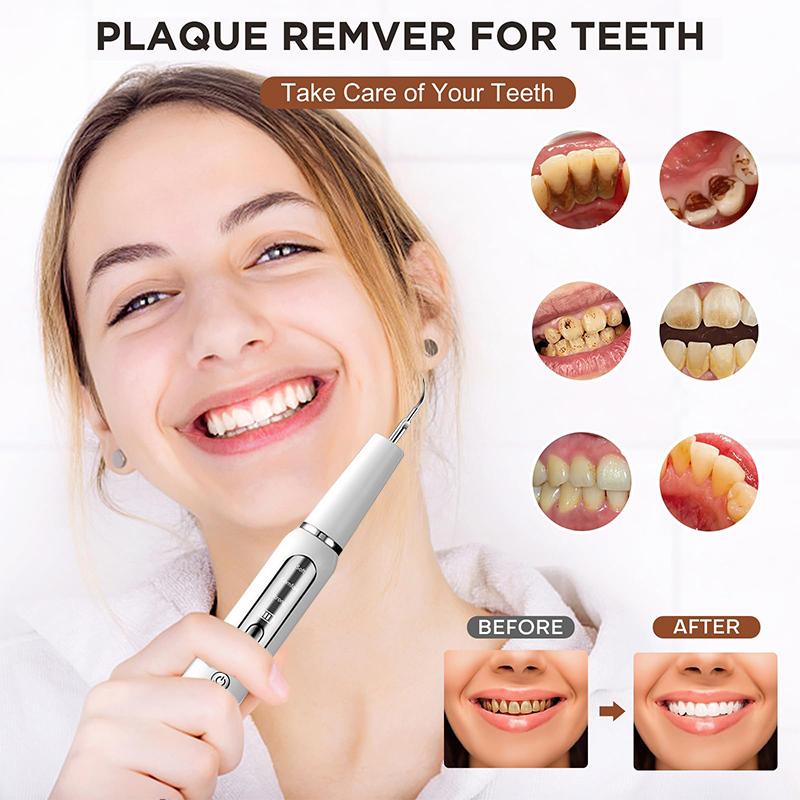 Ультразвуковой зубной скалер для зубов, средство для удаления пятен зубного камня, электрический звуковой очиститель зубов, удаление зубного камня