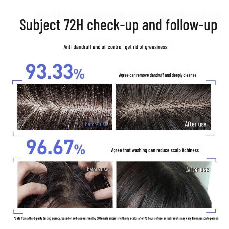 Cai Le Selenium Sulfide Anti-Dandruff Shampoo