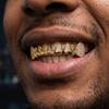 Блестящие Хип-хоп Накладки на Зубы Grillz Съемный Шарм Зубы Grillz Подарок Стразы Накладки на Зубы Рэпер