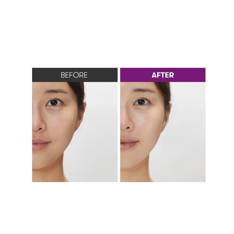 VT Крем-лифтинг Reedle Shot 50 мл