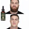 Fast Beard Growth Oil Beard Oil for Men Caffeine Natural Beard Growth Serum Promote Hair Regrowth Professional Keratin