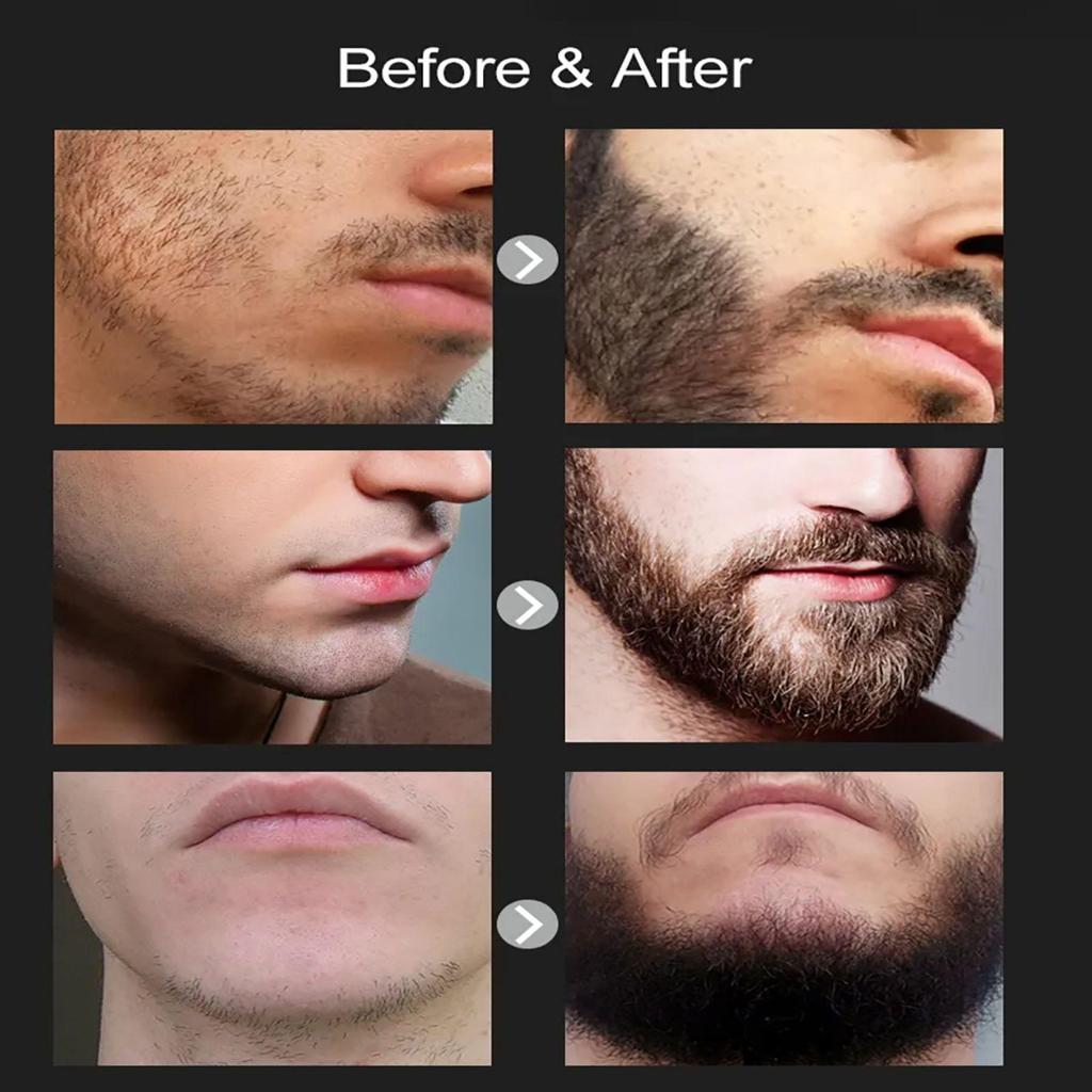 TRSTAY FAST Hair Growth Oil Sprays Beard Grow Seurm Oils Products for Men Anti Hair-loss