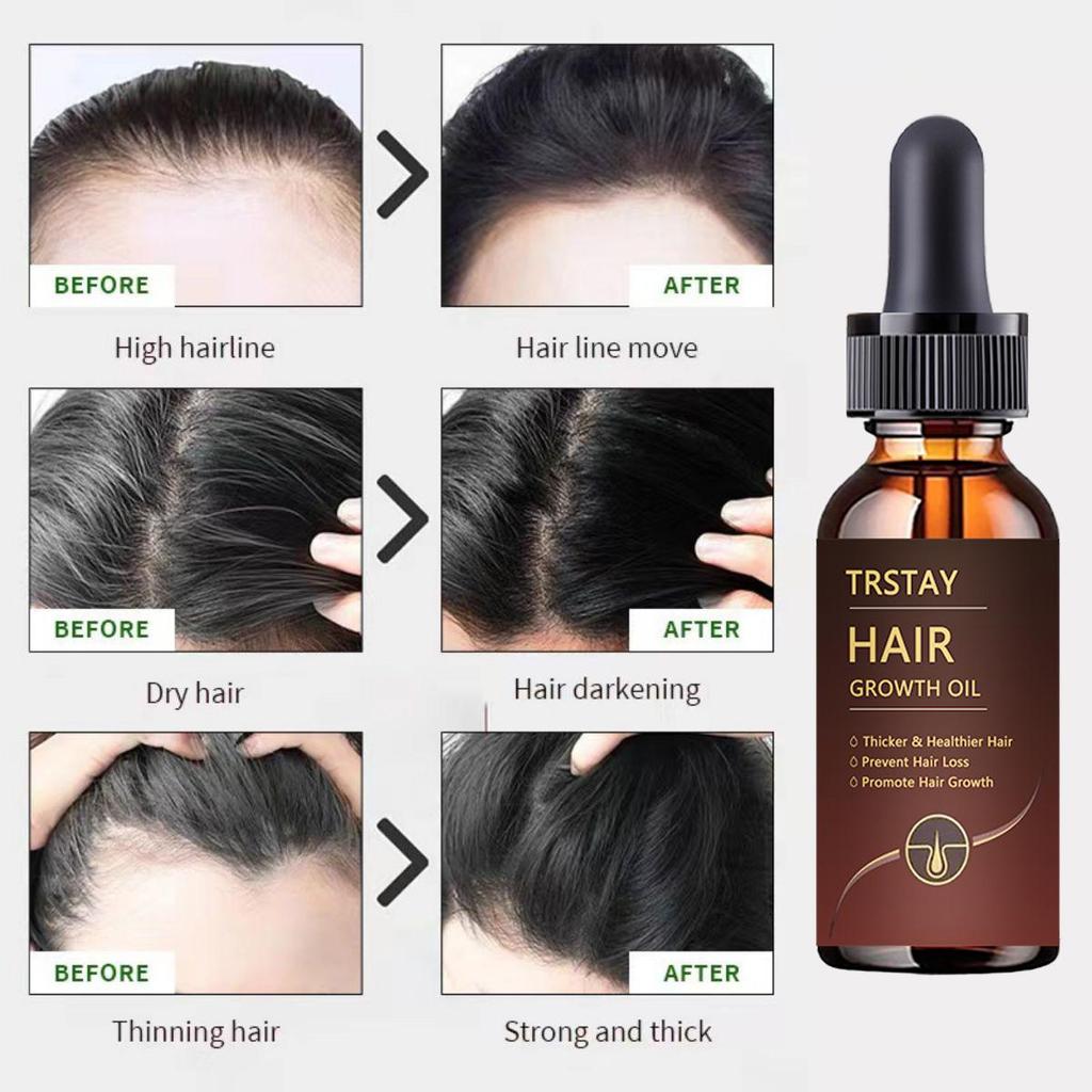 5G/15G/30G/50G/  Helps Repair Fibrous Tissue and Restores Hair Vitality. Contains Nutrients