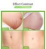 Best Organic Repair Scar Cream Natural Cellulite Removal Anti Pregnancy Stretch Marks Cream For Female