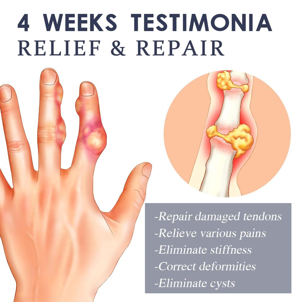 XIMONTH Спрей для суставов с пчелиным ядом, облегчает дискомфорт в суставах и мышцах, расслабляет напряженные и болезненные мышцы, 30 мл