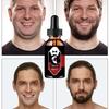 Beard Regrow Oil Natural Hair Growth Protects Seurm Oils Organic Essential Oils Hair Essence Enhancer Care