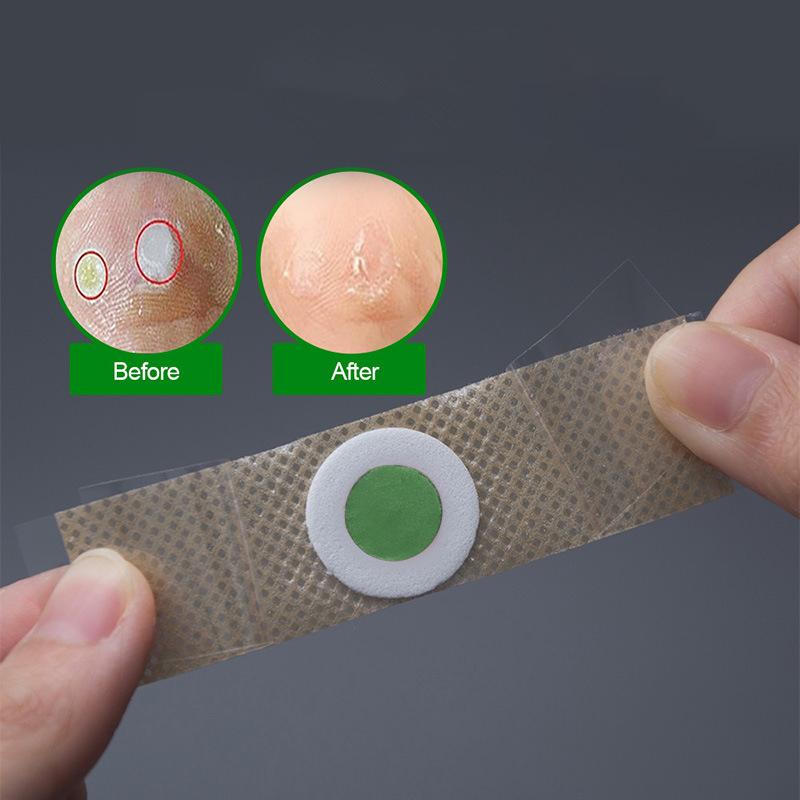 6/12/18/24/30/36 шт. Пластырь для удаления мозолей и натоптышей на ногах, подушечки для мозолей, пластыри, аксессуары для обуви, средства для ухода за ногами