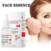 Сыворотка с глутатионом для удаления мелазмы, темных пятен, разбавленная койевая кислота для лица, увлажняющая, отбеливающая, с S I6Q0