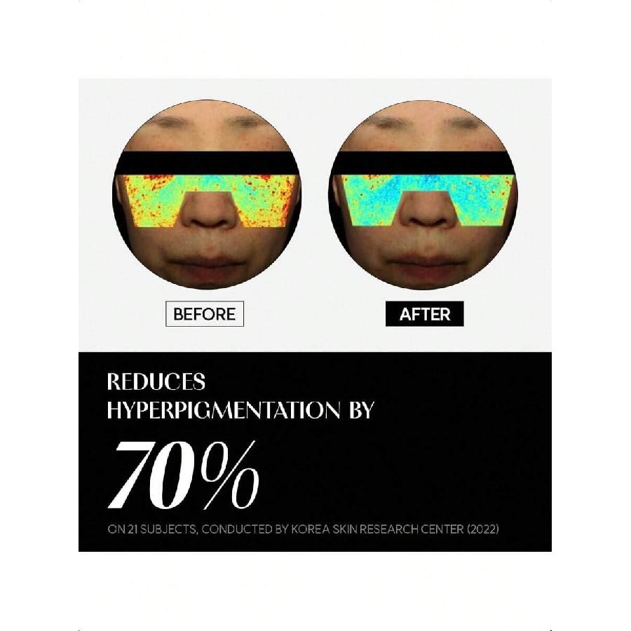 Banobagi Alpha Radiance Serum 30ml | Discoloration Correcting Serum For Face | Facial Oil & Hydrating Serum W/Niacinamide