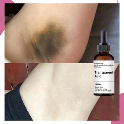 Нежный крем для депиляции не раздражает подмышки, ноги, интимные места, крем для депиляции рук, крем для безболезненной депиляции тела