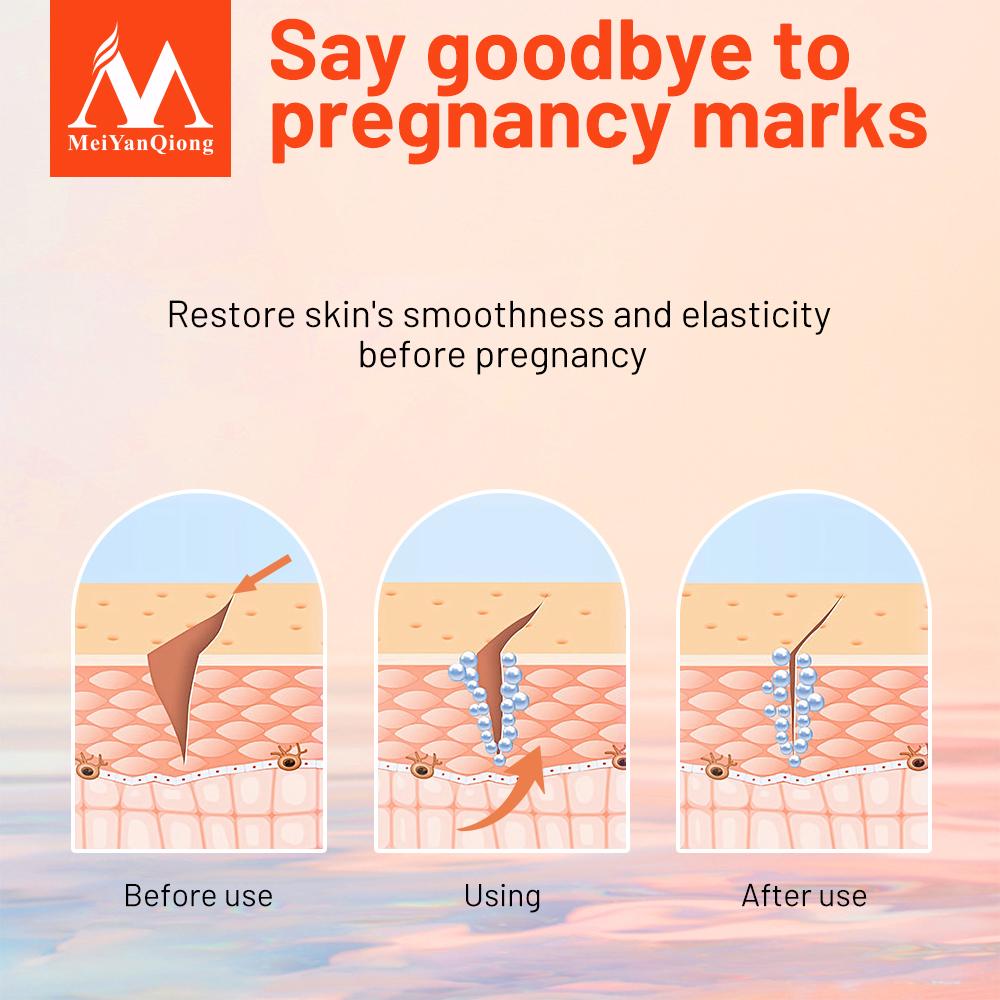 Восстанавливающий крем для тела против растяжек и шрамов 35г