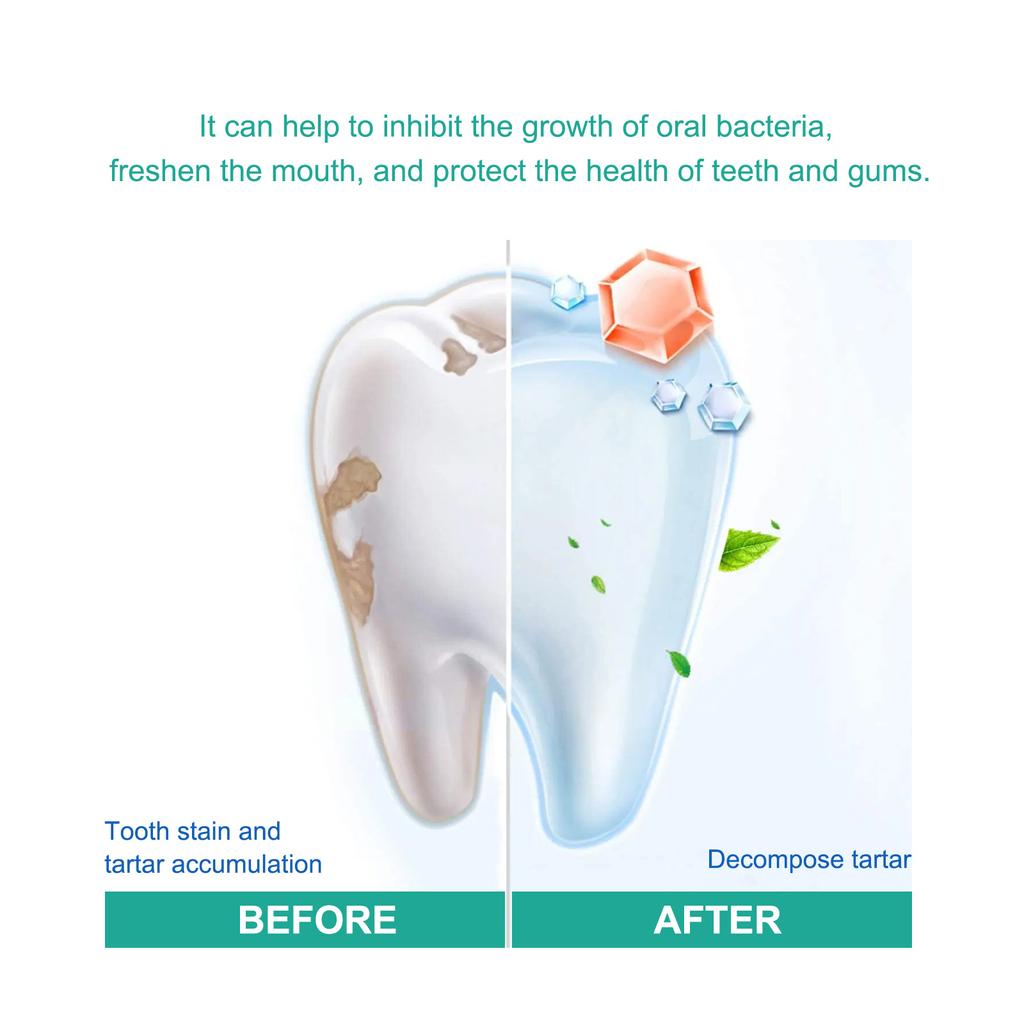 EELHOE Очищение зубов, отбеливающий мусс, зубная паста для глубокой очистки, пена, зубная паста удаляет пятна, свежее дыхание, инструменты для ухода за зубами, 30 мл