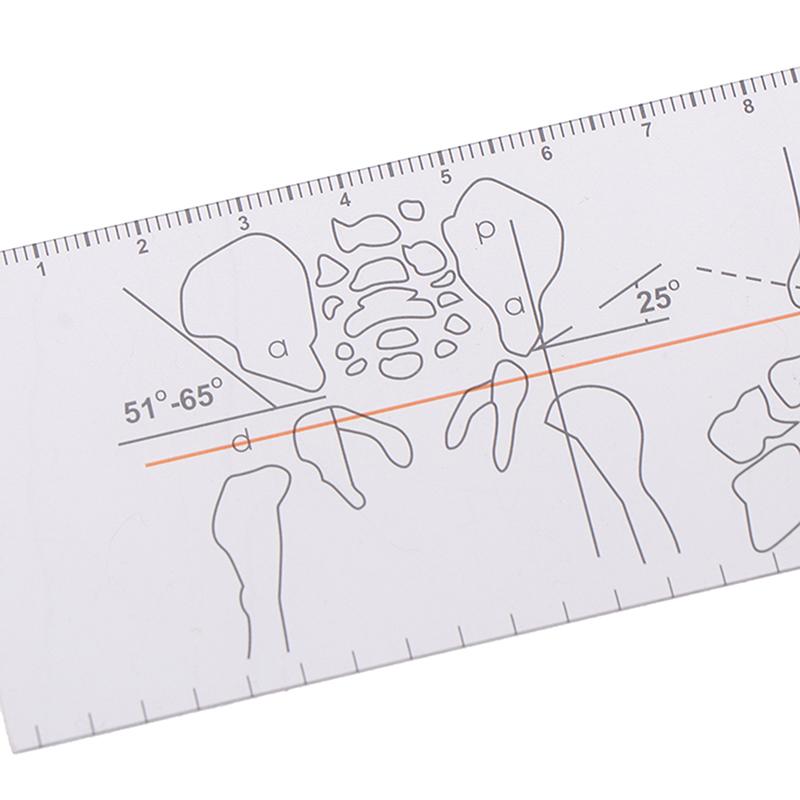 Многолинейный гониометр, угловая медицинская линейка, инструменты для ортопедии суставов