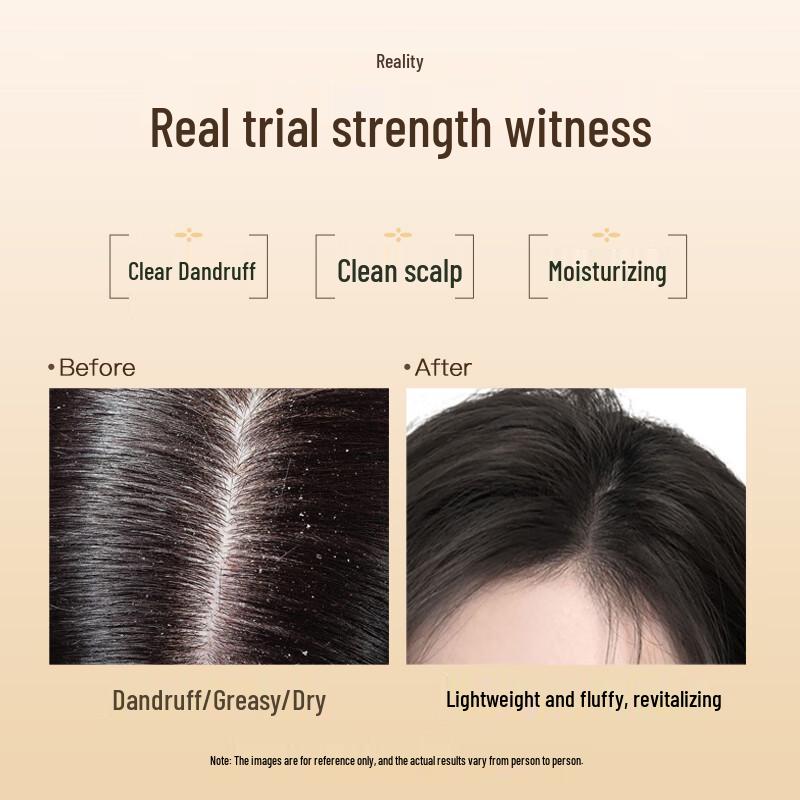 Dieyin Horse Oil Anti-Dandruff Shampoo