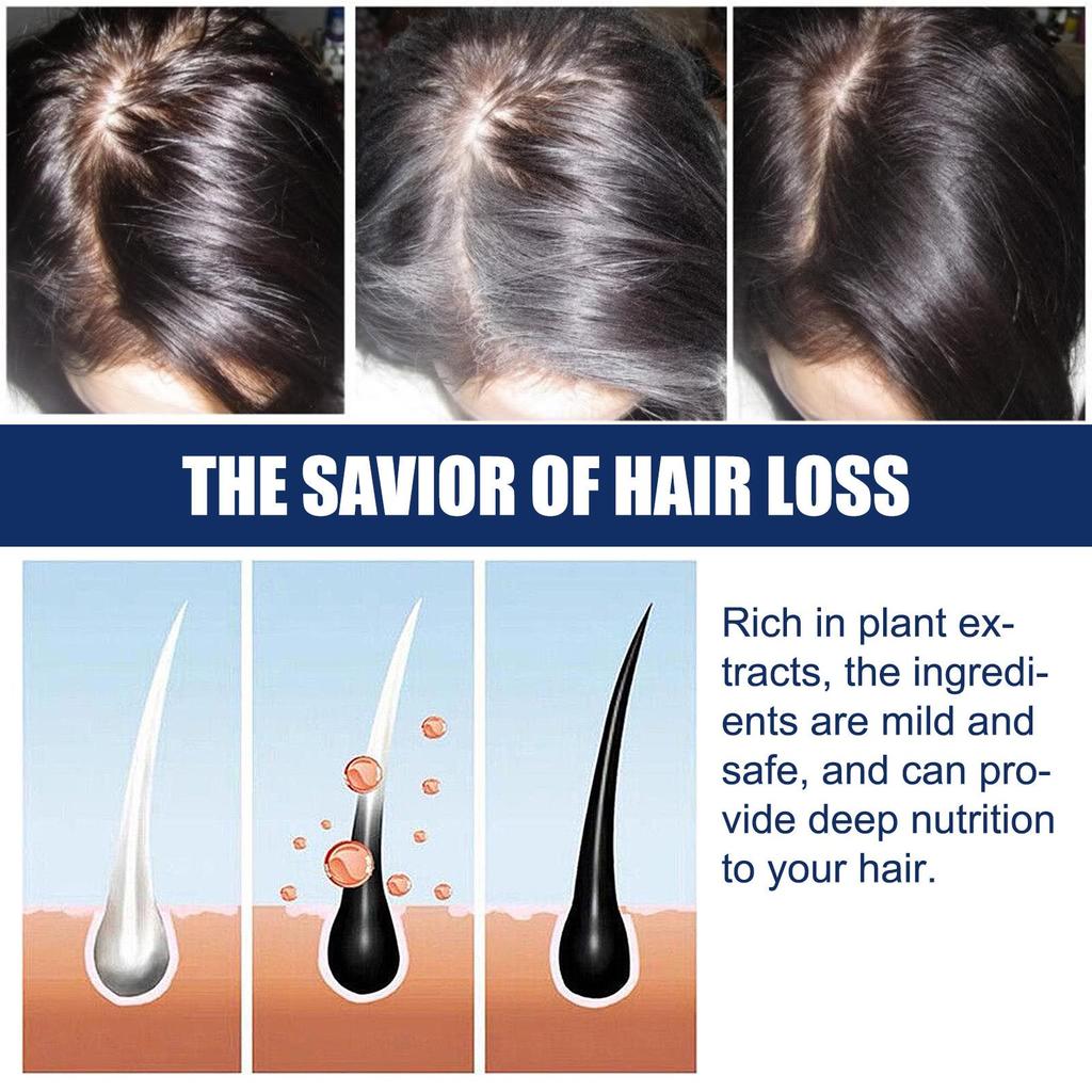 Крем Средства против выпадения волос Быстрорастущие Предотвращают сухость Пушистость Поврежденные Лечебное средство Уход за кожей головы Борода Мужчины Женщины 20 г