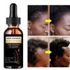 Сыворотка-спрей для роста волос с имбирем, против выпадения волос, основные продукты, быстрое лечение, предотвращает истончение волос, сухое, вьющееся восстанавливающее масло