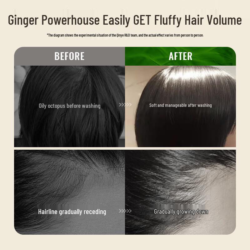 Q&Y Ginger & Arborvitae Hair Treatment Shampoos