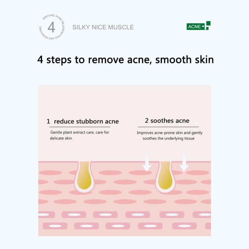 Эффективный крем для удаления угрей, травяной крем для контроля жирности, удаления шрамов от угревой сыпи, отбеливающий увлажняющий гель для лица, уход за кожей