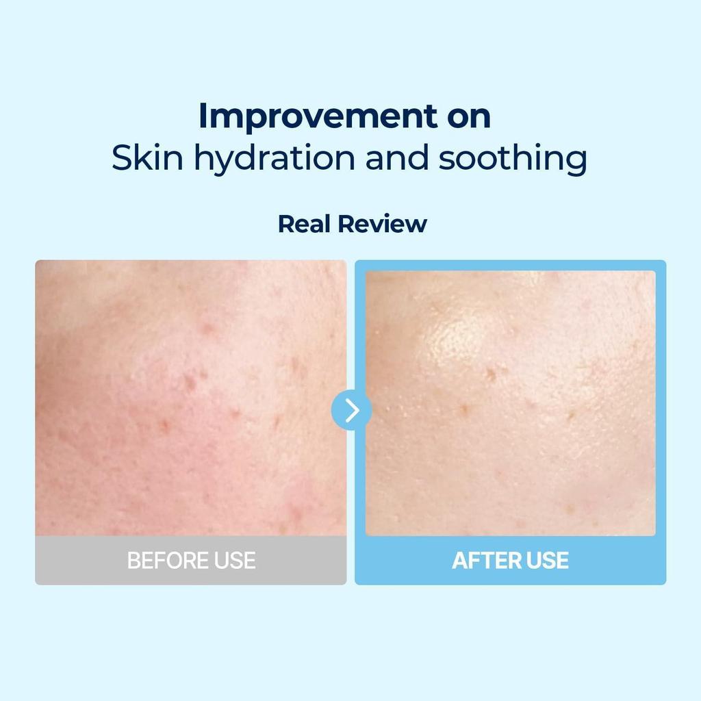 TORRIDEN DIVE-IN Мульти-пэды с низкомолекулярной гиалуроновой кислотой 160мл 80шт