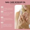 Nail FungusTreatment Toenail And FingerAnti-Fungal For Discolored Or Damaged Nails.30ml
