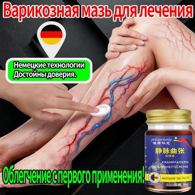 Китайская мазь от варикозного расширения вен для ног, 50 г