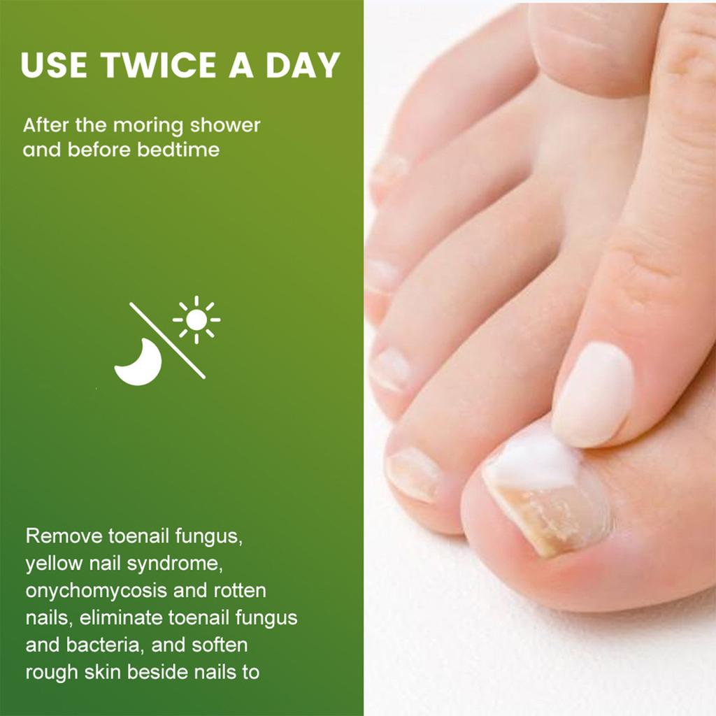 Пластырь, серый крем для ногтей, новый яркий калиевый крем для ногтей, с пилочкой