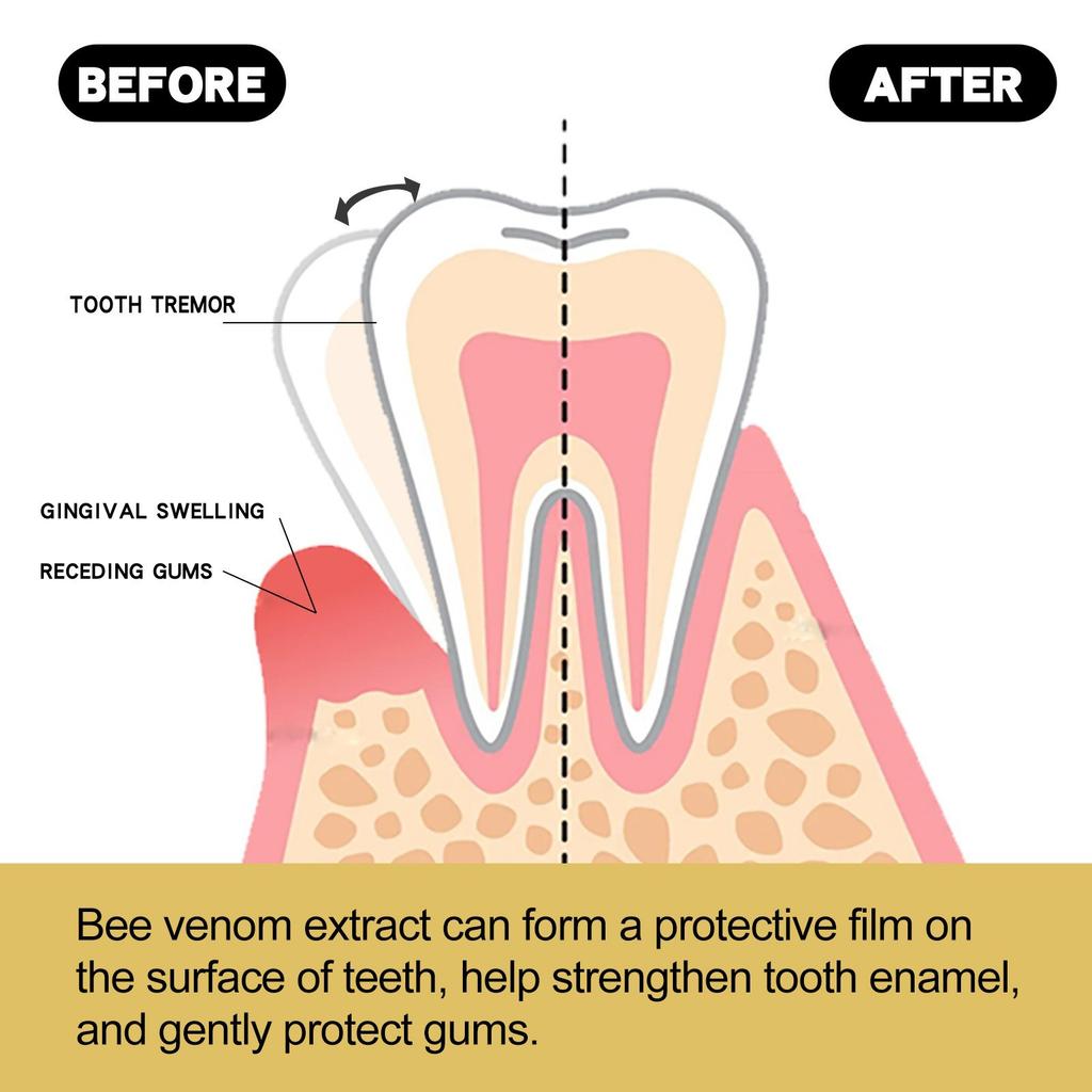 Bee Gingival Toothpaste Deep Clean Tooth Stains Toothicidal Mouthpiece Tooth Stain Removal, Teeth Whitening Booster  110g