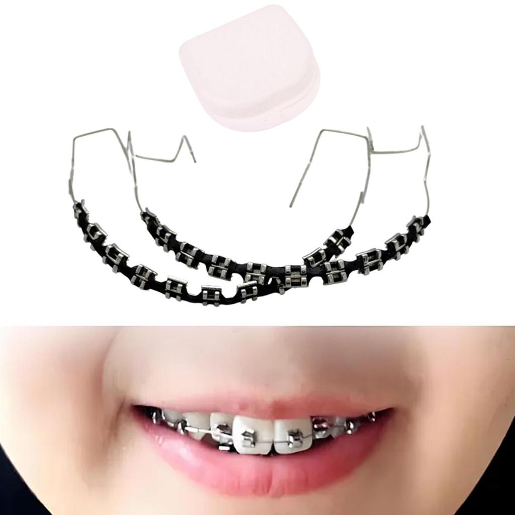 Temporary Tooth Decoration,Orthodontist Explain Props with Metal Wires
