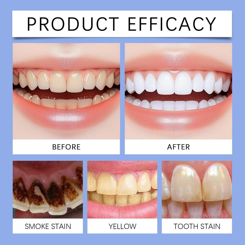 Baking Soda Probiotic Whitening Toothpaste Remove Yellow Teeth Stain Tartar Brighten Dental Protect Gum Fresh Mouth Oral Care