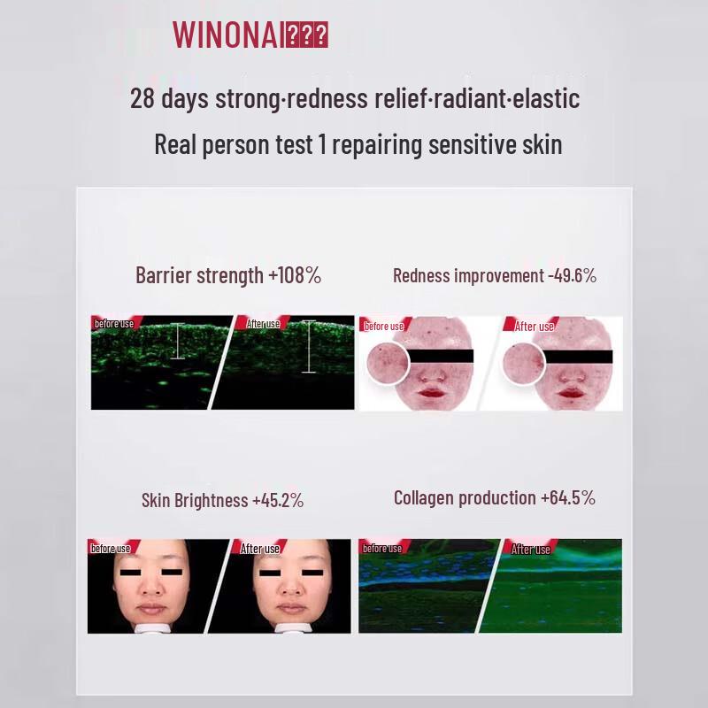WINONA Успокаивающая и увлажняющая специальная уходовая эссенция (2-е поколение)