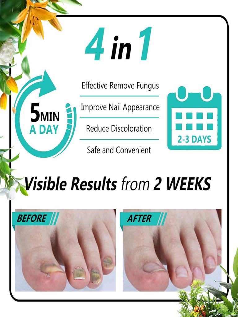 5 мл/15 мл/30 мл/50 мл/Crazylife Hand And Foot Nail Onycho Repair Nail Onychomycetant для утолщения ногтей, подавитель